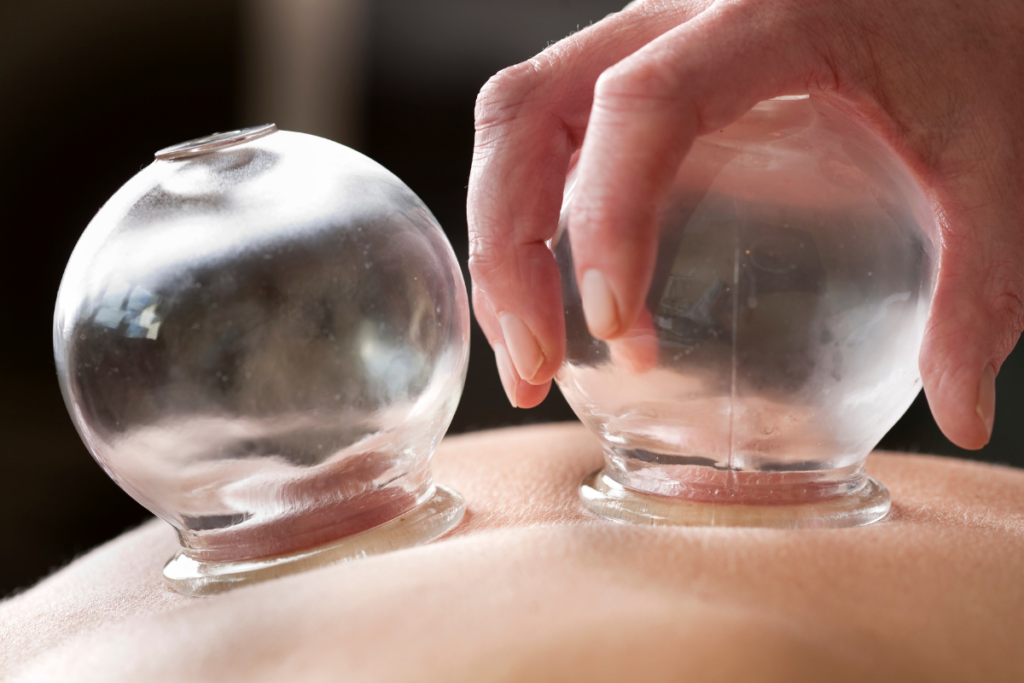 Cupping Massage